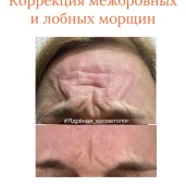 косметология you_studio изображение 5 на проекте moekrylatskoe.ru